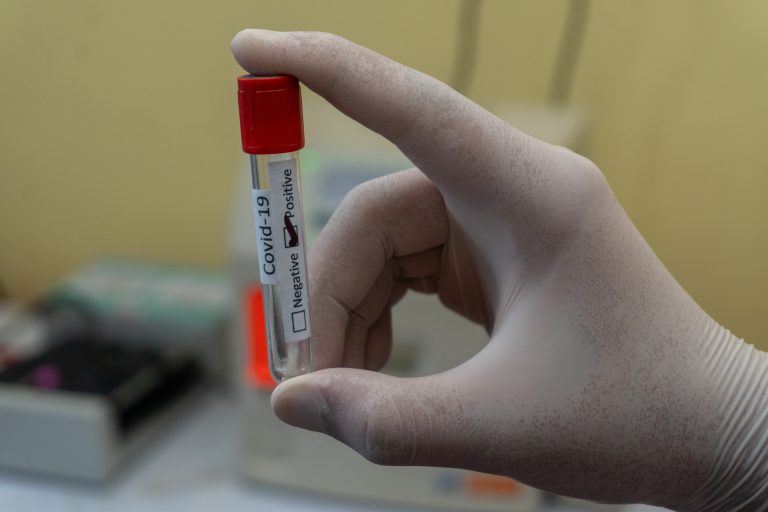 Coronatest